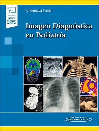 Portada del libro 9788491106296 Imagen Diagnóstica en Pediatría