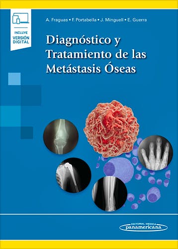 Portada del libro 9788491107804 Diagnóstico y Tratamiento de las Metástasis Óseas (Incluye Versión Digital)