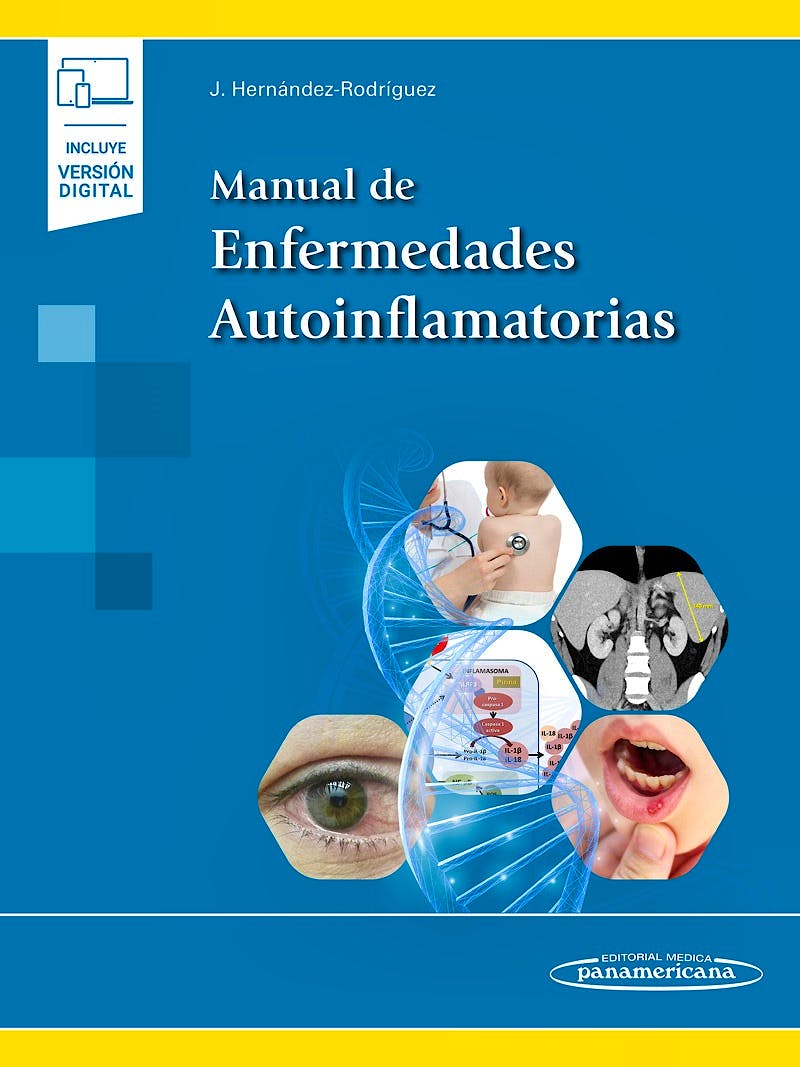 Portada del libro 9788491109143 Manual de Enfermedades Autoinflamatorias