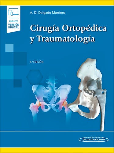 Portada del libro 9788491109174 Cirugía Ortopédica y Traumatología