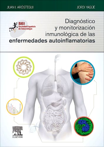 Portada del libro 9788491131076 Diagnóstico y Monitorización Inmunológica de las Enfermedades Autoinflamatorias