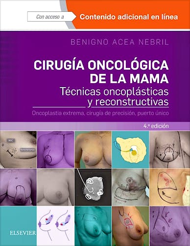 Portada del libro 9788491131120 Cirugía Oncológica de la Mama. Técnicas Oncoplásticas y Reconstructivas. Oncoplastia Extrema, Cirugía de Precisión, Puerto Único + Acceso Online