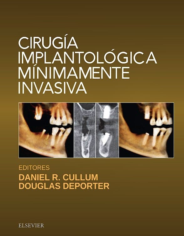 Portada del libro 9788491131526 Cirugía Implantológica Mínimamente Invasiva
