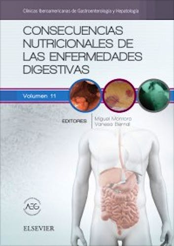 Portada del libro 9788491131687 Consecuencias Nutricionales de las Enfermedades Digestivas (Clínicas Iberoamericanas de Gastroenterología y Hepatología, Vol. 11)