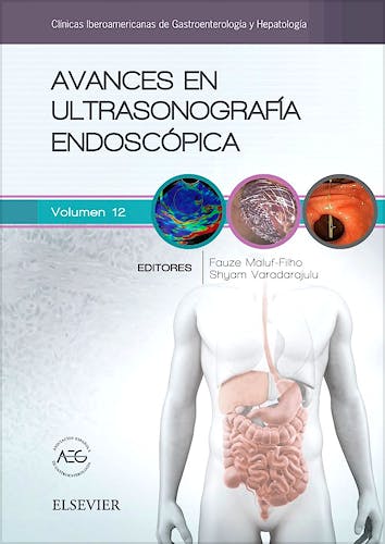 Portada del libro 9788491131748 Avances en Ultrasonografía Endoscópica (Clínicas Iberoamericanas de Gastroenterología y Hepatología, Vol. 12)