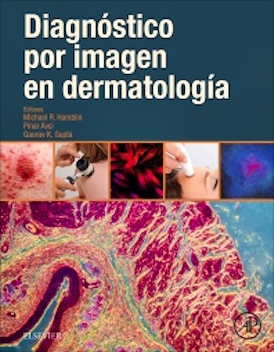 Diagnóstico por Imagen en Dermatología