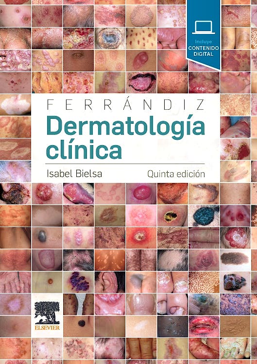 Portada del libro 9788491132646 FERRÁNDIZ Dermatología Clínica + Acceso Online