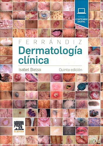 Portada del libro 9788491132646 FERRÁNDIZ Dermatología Clínica + Acceso Online