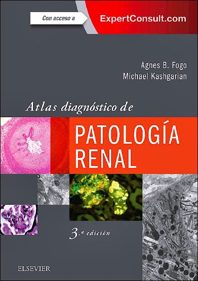 Portada del libro 9788491132936 Atlas Diagnóstico de Patología Renal + Acceso Online al Libro en Inglés