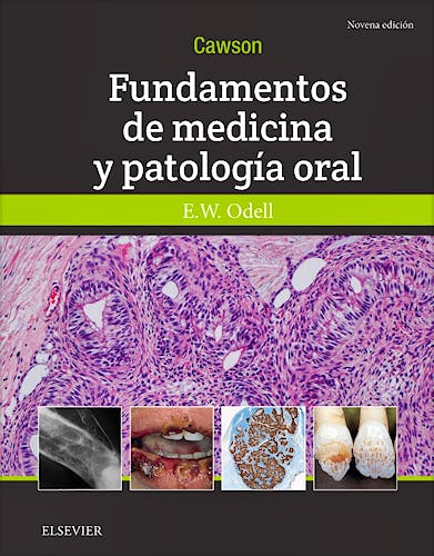 Portada del libro 9788491133155 CAWSON Fundamentos de Medicina y Patología Oral
