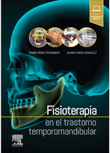 Fisioterapia en el Trastorno Temporomandibular