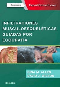 Infiltraciones Musculoesqueléticas Guiadas por Ecografía