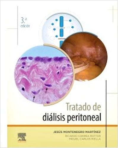 Portada del libro 9788491134718 Tratado de Diálisis Peritoneal