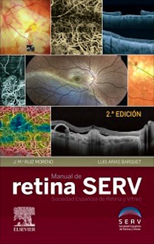 Portada del libro 9788491135647 Manual de Retina SERV (Sociedad Española de Retina y Vítreo)