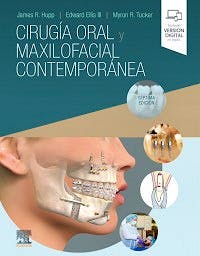 Portada del libro 9788491136354 Cirugía Oral y Maxilofacial Contemporánea
