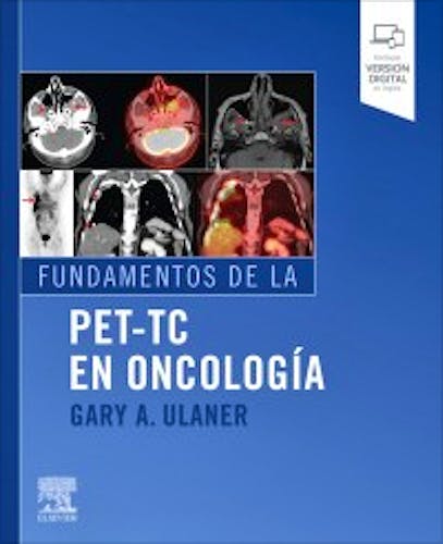 Portada del libro 9788491136736 Fundamentos de la PET-TC en Oncología