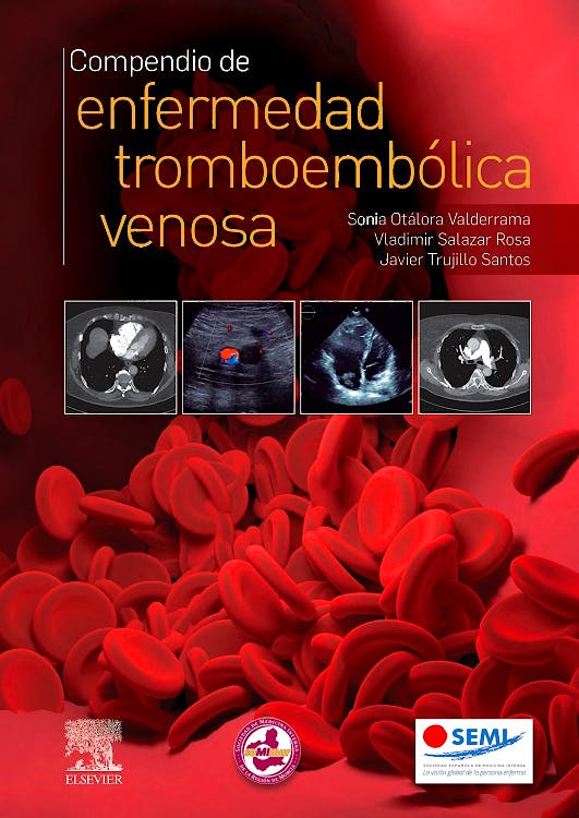 Portada del libro 9788491137276 Compendio de Enfermedad Tromboembólica Venosa