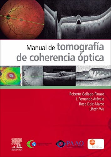 Portada del libro 9788491138297 Manual de Tomografía de Coherencia Óptica
