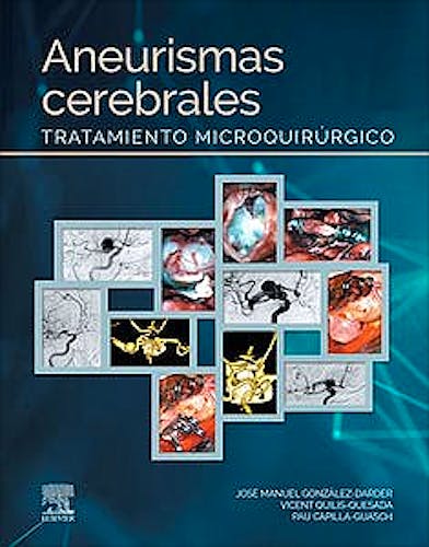 Portada del libro 9788491138853 Aneurismas Cerebrales. Tratamiento Microquirúrgico