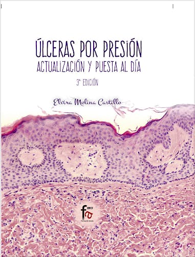 Portada del libro 9788491496328 Úlceras por Presión. Actualización y Puesta al Día