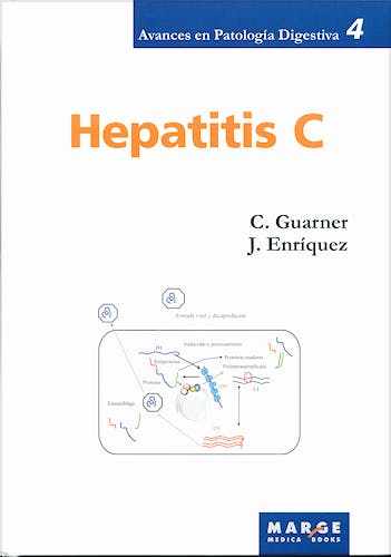 Portada del libro 9788492442096 Hepatitis C (Avances en Patologia Digestiva, Vol. 4)