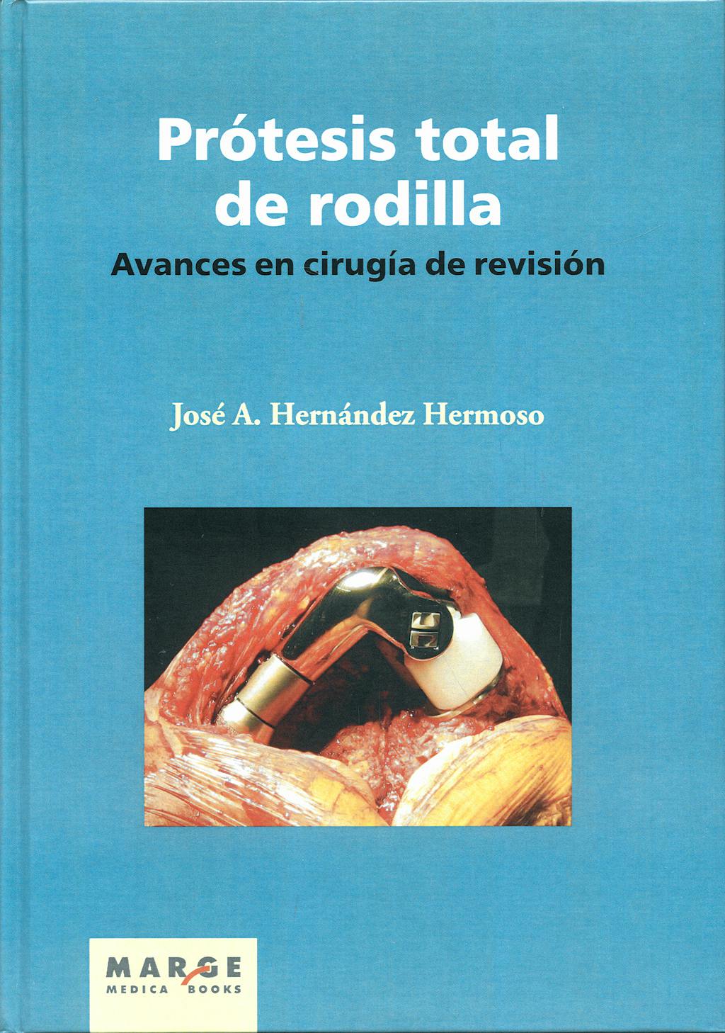 Portada del libro 9788492442119 Protesis Total de Rodilla. Avances en Cirugia de Revision