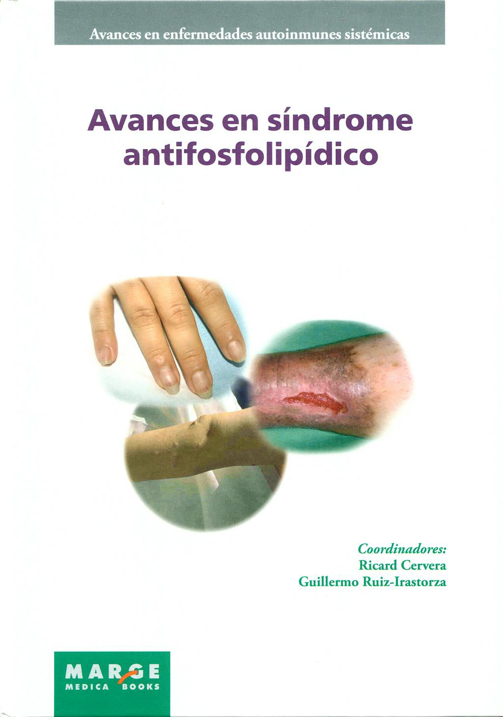 Portada del libro 9788492442430 Avances en Sindrome Antifosfolipidico (Avances en Enfermedades Autoinmunes Sistemicas)