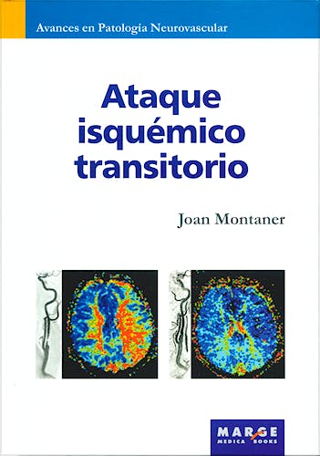 Portada del libro 9788492442485 Ataque Isquemico Transitorio (Avances en Patologia Neurovascular, Vol. 5)