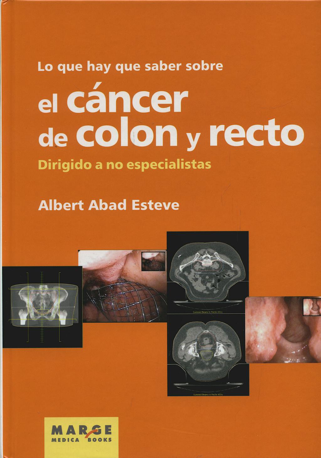 Portada del libro 9788492442546 Lo que Hay que Saber contra el Cancer de Colon y Recto. Dirigido a no Especialistas