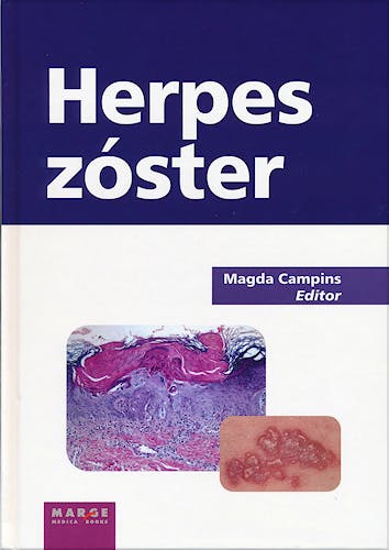 Portada del libro 9788492442812 Herpes Zoster