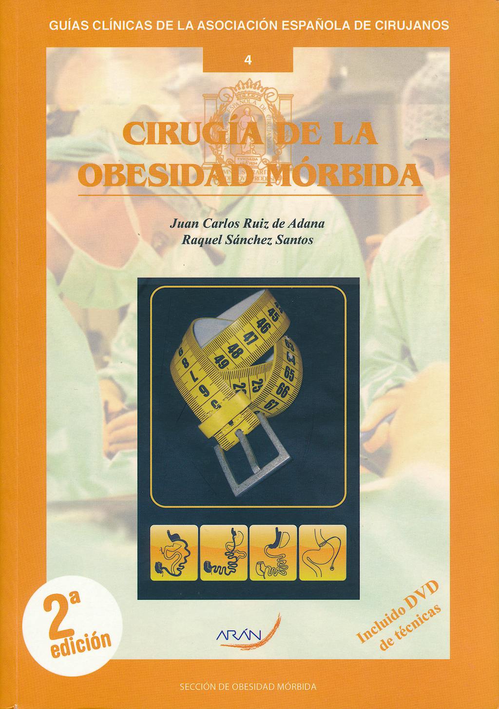 Portada del libro 9788492977413 Cirugía de la Obesidad Mórbida de Técnicas (Guías Clínicas de la Asociación Española de Cirujanos Nº 4)