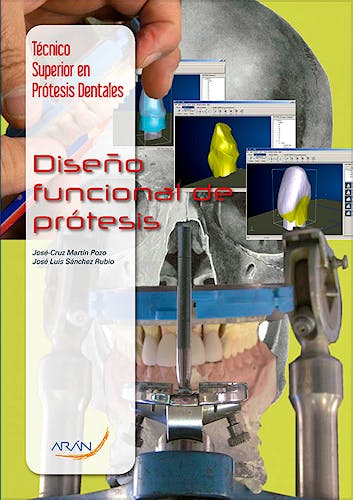 Portada del libro 9788492977666 Diseño Funcional de Prótesis (Técnico Superior en Prótesis Dentales)
