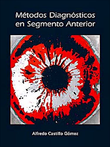 Portada del libro 9788493314491 Métodos Diagnósticos en Segmento Anterior (Monografías SECOIR)