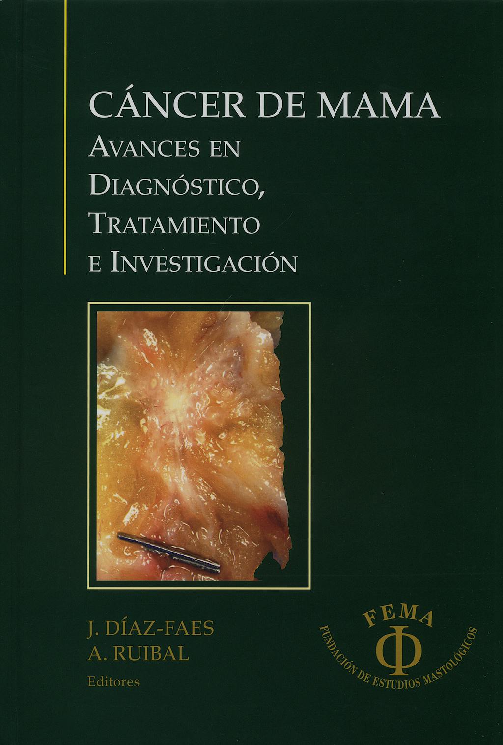 Portada del libro 9788493457839 Cancer de Mama. Avances en Diagnostico Tratamiento e Investigacion