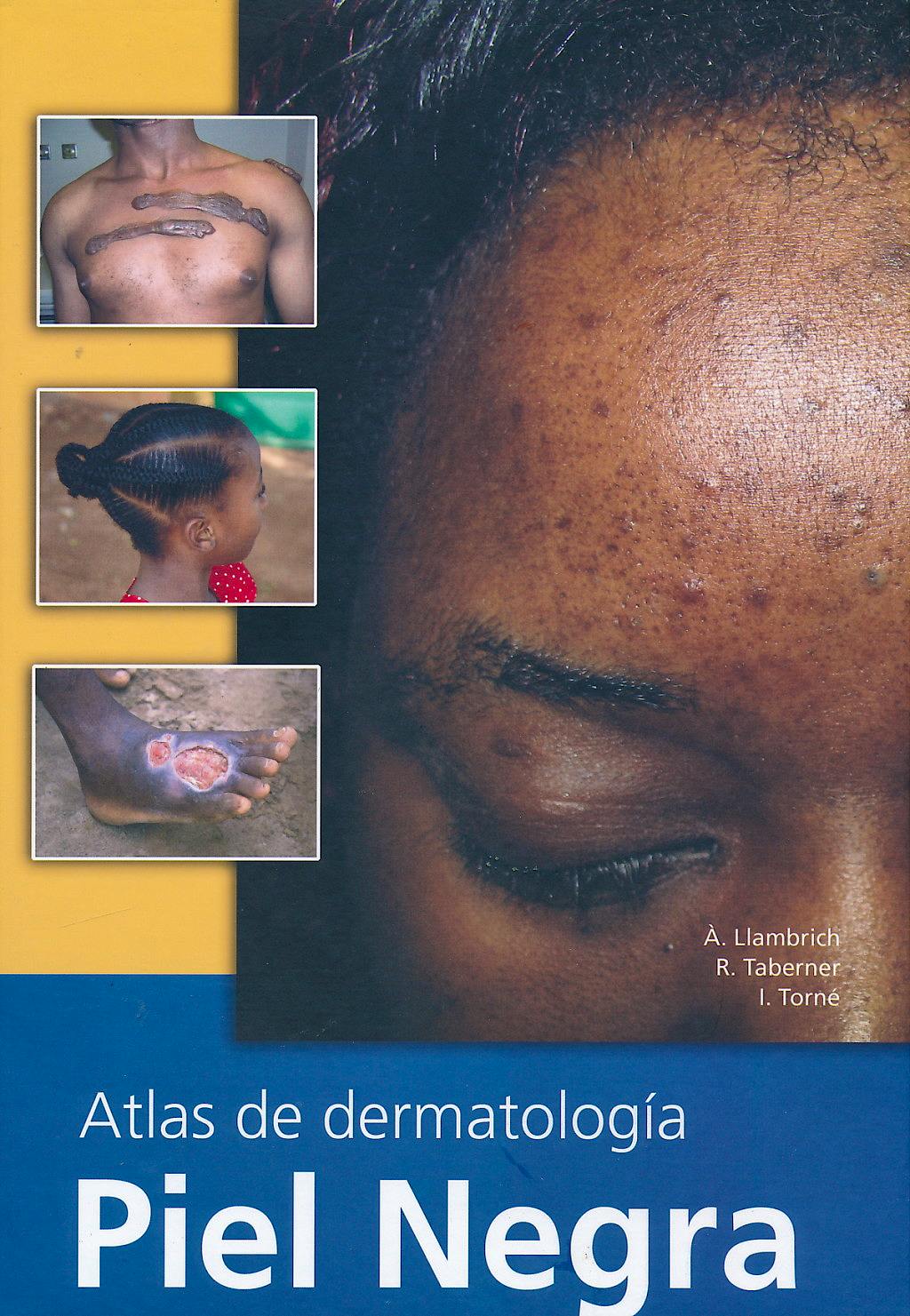 Portada del libro 9788493664640 Atlas de Dermatologia. Piel Negra