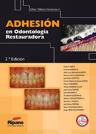 Portada del libro 9788493723873 Adhesion en Odontologia Restauradora