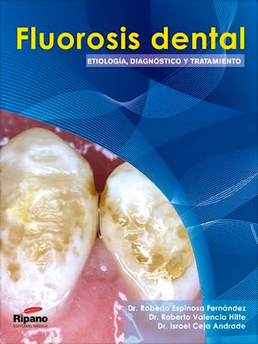 Portada del libro 9788493779313 Fluorosis Dental. Etiologia, Diagnostico y Tratamiento