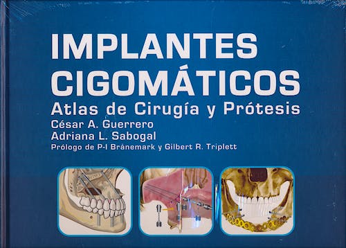 Portada del libro 9788493779320 Implantes Cigomáticos. Atlas de Cirugía y Prótesis