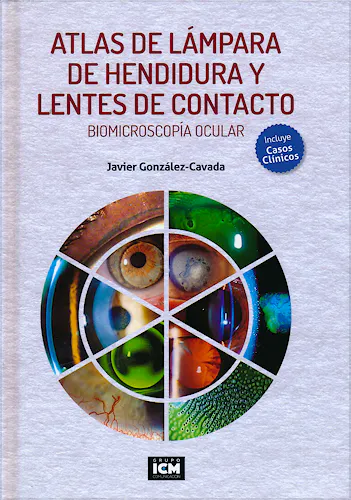 Portada del libro 9788493965686 Atlas de Lámpara de Hendidura y Lentes de Contacto. Biomicroscopía Ocular