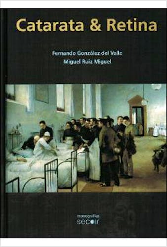 Portada del libro 9788493989828 Catarata y Retina (Monografías SECOIR)