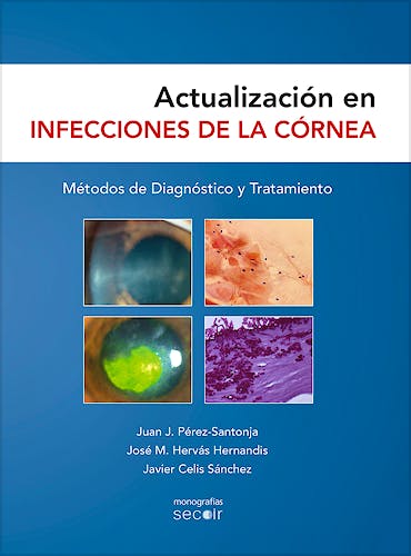 Portada del libro 9788493989835 Actualización en Infecciones de la Córnea. Métodos de Diagnóstico y Tratamiento (Monografías SECOIR)