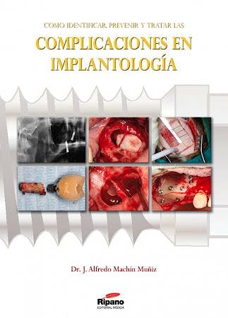 Portada del libro 9788494023200 Como Identificar, Prevenir y Tratar las Complicaciones en Implantologia