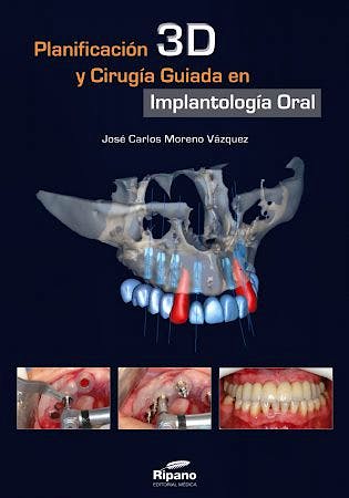Portada del libro 9788494023217 Planificación 3D y Cirugía Guiada en Implantología Oral