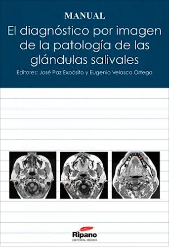 Portada del libro 9788494023286 El Diagnóstico por Imagen de la Patología de las Glándulas Salivales. Manual