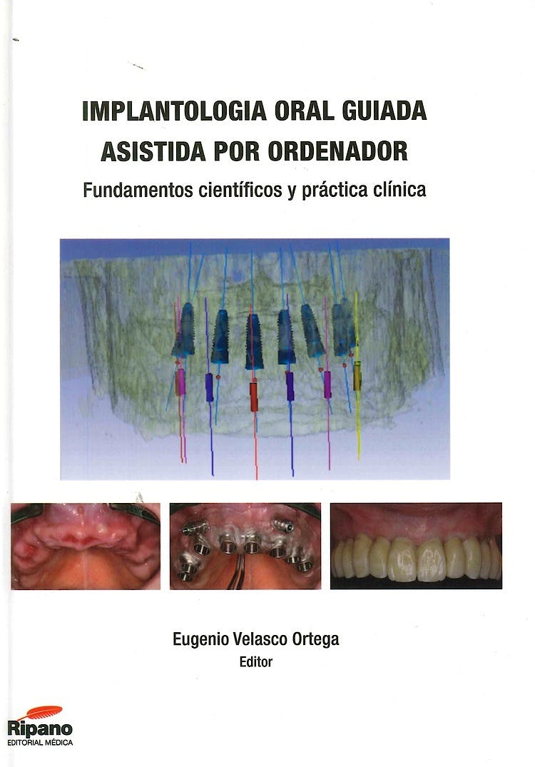 Portada del libro 9788494126925 Implantologia Oral Guiada Asistida por Ordenador