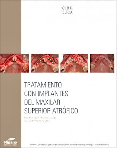 Portada del libro 9788494260117 Tratamiento con Implantes del Maxilar Superior Atrófico