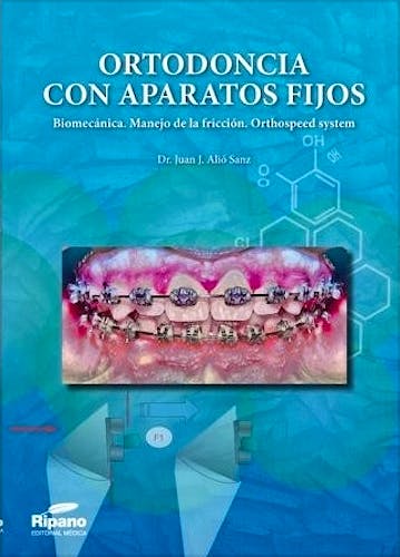 Portada del libro 9788494260162 Ortodoncia con Aparatos Fijos. Biomecánica, Manejo de la Fricción, Orthospeed System