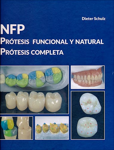 Portada del libro 9788494466304 NFP Prótesis Funcional y Natural. Prótesis Completa