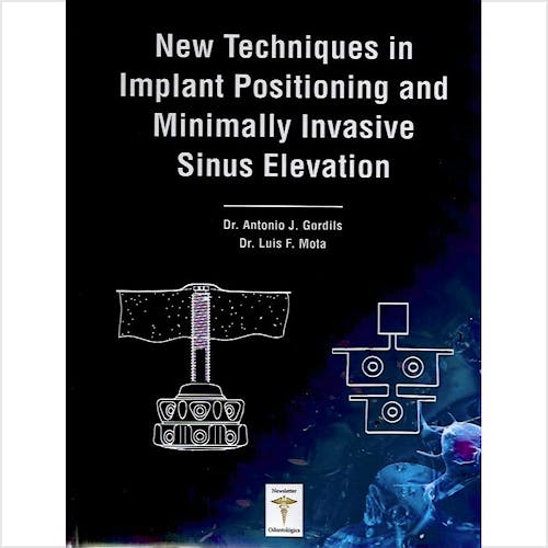 Portada del libro 9788494494413 New Techniques in Implant Positioning and Minimally Invasive Sinus Elevation