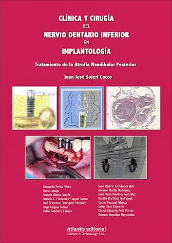 Portada del libro 9788494559051 Clínica y Cirugía del Nervio Dentario Inferior en Implantología. Tratamiento de la Atrofia Mandibular Posterior
